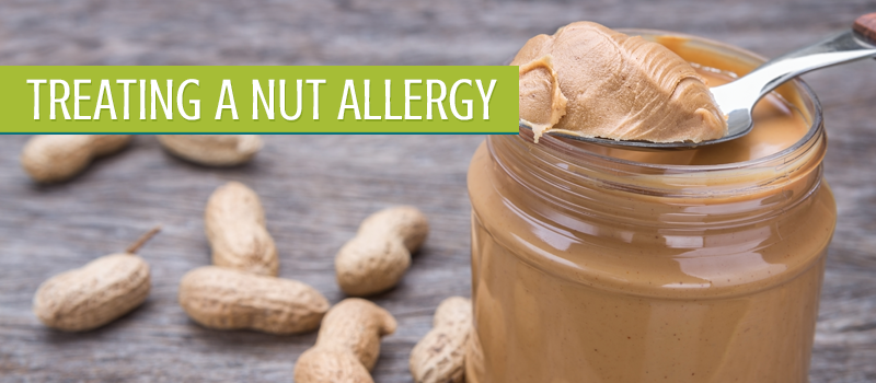 Treat a Nut Allergy