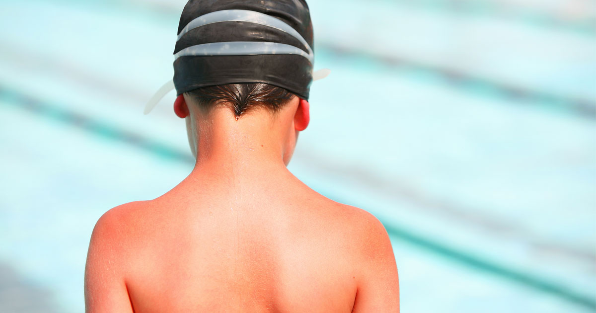 child sunburn while swimming